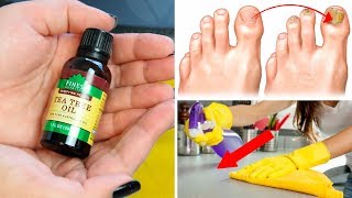 What is Melaleuca Essential Oil for? For This and More ...