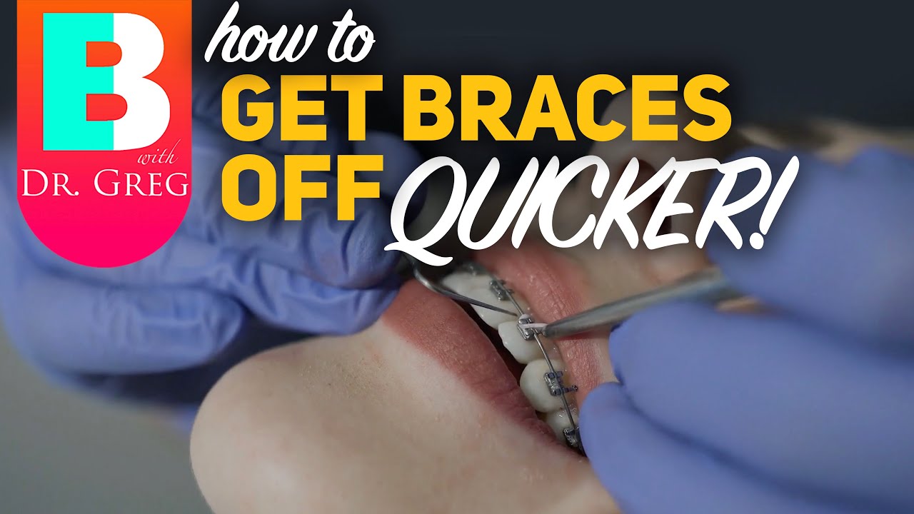 How To Speed Up Braces Time