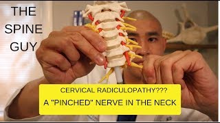 CERVICAL STENOSIS RADICULOPATHY: PART 1  SYMPTOMS, IMAGING AND PATIENT EXAM