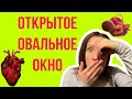 ОТКРЫТОЕ ОВАЛЬНОЕ ОКНО У РЕБЁНКА НА ЭХО-КГ: это страшно?!