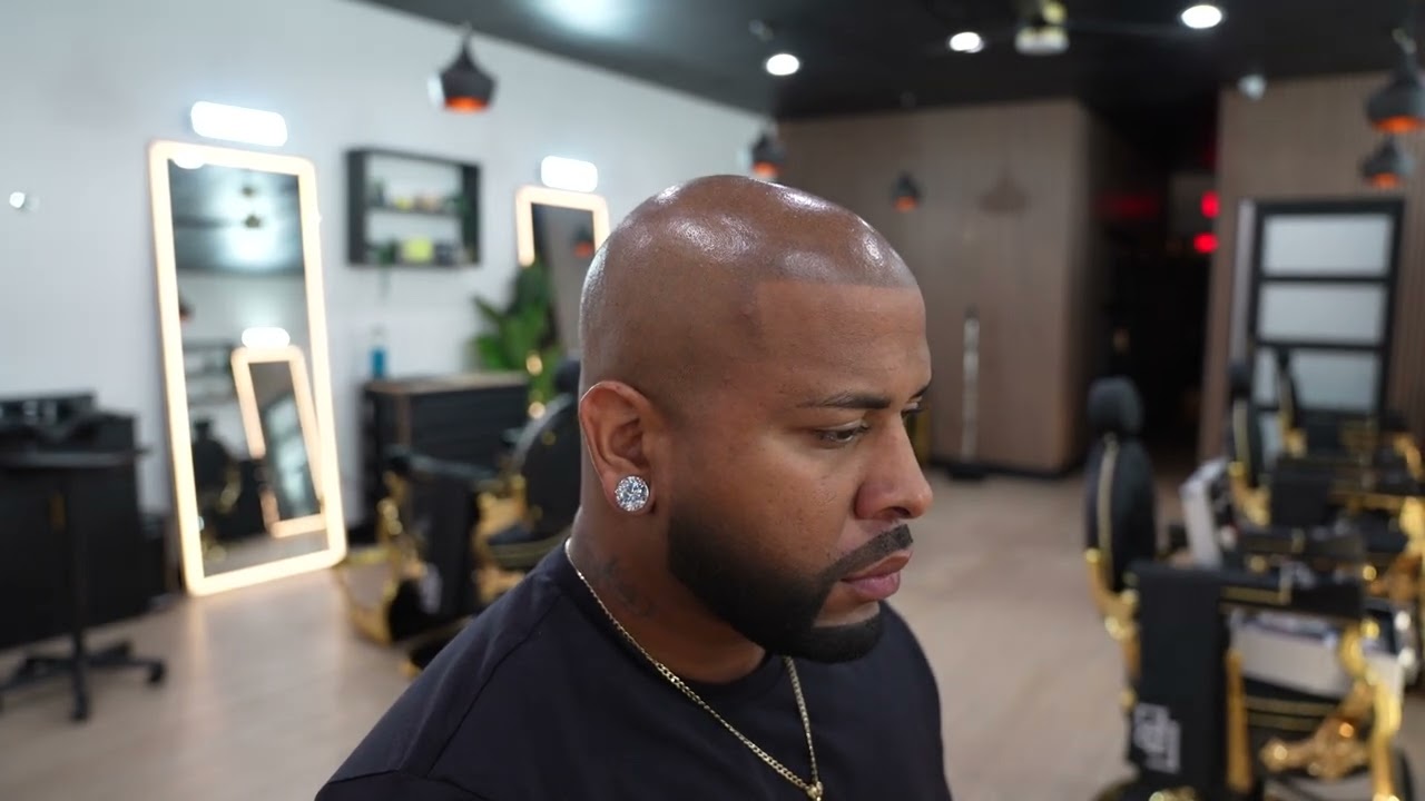 Scalp Ink SMP Studio – Transform Your Look with Scalp Micropigmentation