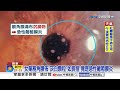女業務"角膜長青春痘"險瞎?! 醫曝元凶竟是"高溫+熬夜"?!│中視新聞 20260717