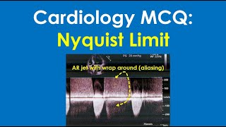 Cardiology MCQ: Nyquist limit