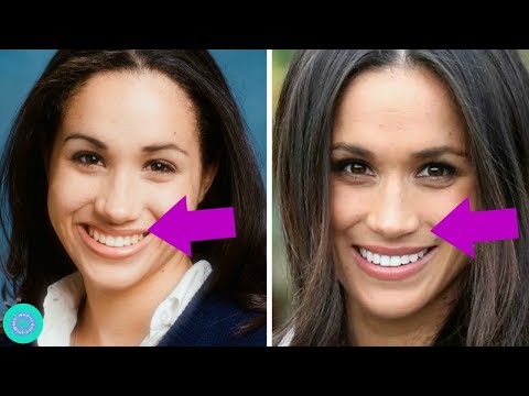 Video: Tren Baru Dalam Plastik: Wajah Seperti Meghan Markle