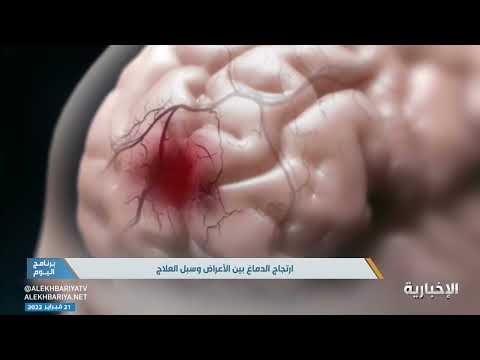 فيديو: كيفية جعل العكازات أكثر راحة: 9 خطوات