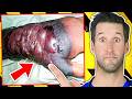 ER Doctor REACTS to World&#39;s Most Deadliest Diseases