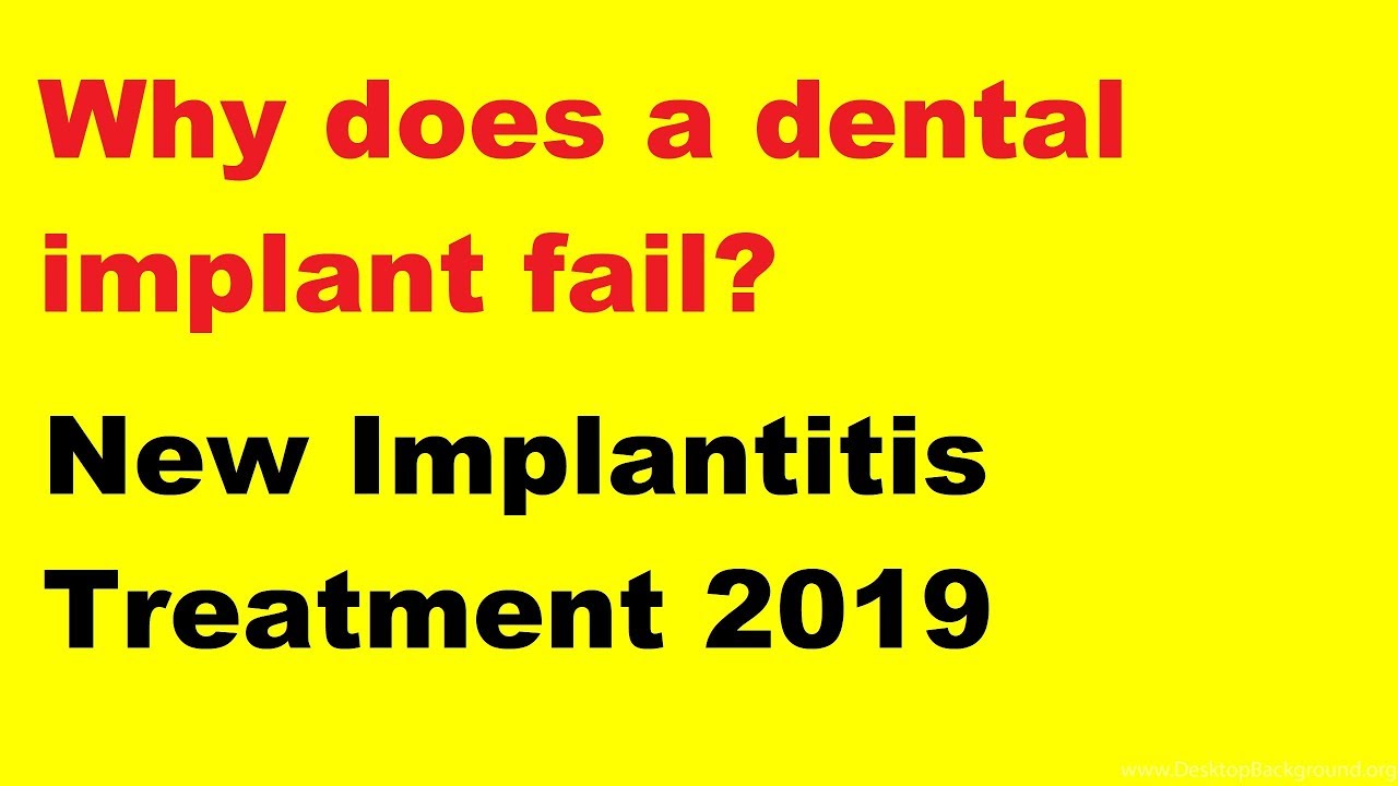 Why does a dental implant fail? New Treatment (2019) YouTube