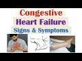 Congestive Heart Failure Signs & Symptoms (& Why They Occur)