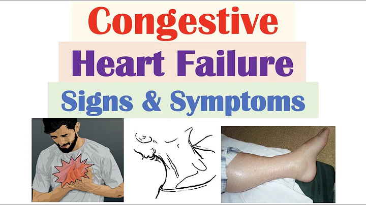 Congestive Heart Failure Signs & Symptoms (& Why They Occur) - DayDayNews