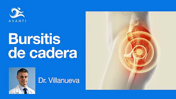 ¿Qué ocurre si no se trata la bursitis de cadera?