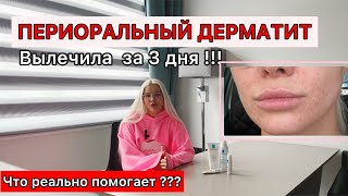 ПЕРИОРАЛЬНЫЙ ДЕРМАТИТ ЧЕМ ЛЕЧИТЬ. ДЕРМАТИТ У ВЗРОСЛЫХ.