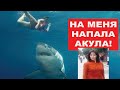 На меня напала акула Как это было