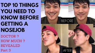 Top 10 Things You Need to Know Before Getting A Nosejob (Rhinoplasty) Part 3 Philippines Part  3