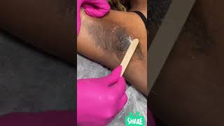 Underarm waxing/hard & soft wax. #shortfeeds #waxing
