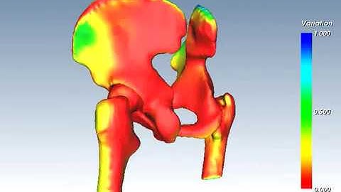 Statistical shape model of the hip joint