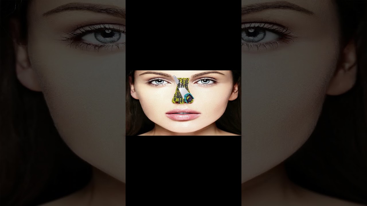 Asmr Animation| Nose treatment|2D Animation| 