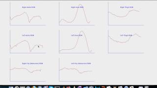 Gait Analysis Project