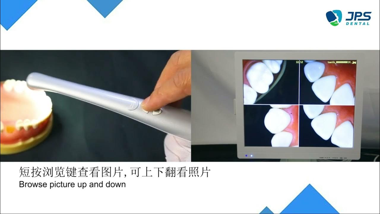 How to Use Intraoral Camera? JPS DENTAL YouTube