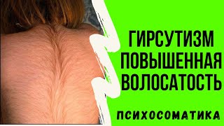 видео Повышенная волосатость у женщин и мужчин — как избавиться от нежелательных волос | BeautyGuild