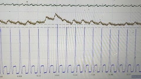 In Cylinder Pressure Transducer Testing- Mercedes Misfire Diag
