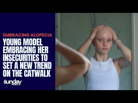 Young Model Embracing Alopecia To Set A New Trend On The Catwalk