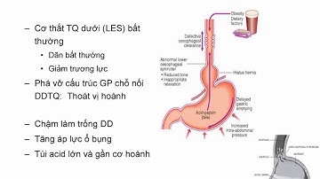 Chẩn đoán và điều trị GERD (Trào ngược dạ dày thực quản)