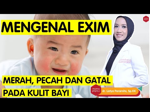 Video: 4 Cara Merawat Ekzema pada Bayi Secara Semula Jadi