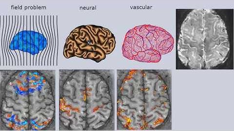 Renzo Huber: Differentiating neural and non-neural fMRI signals using CBV-BOLD fMRI
