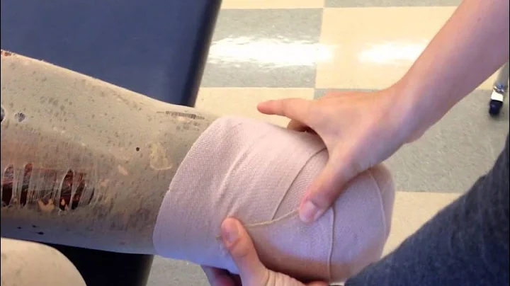 Ace wrapping residual limbs