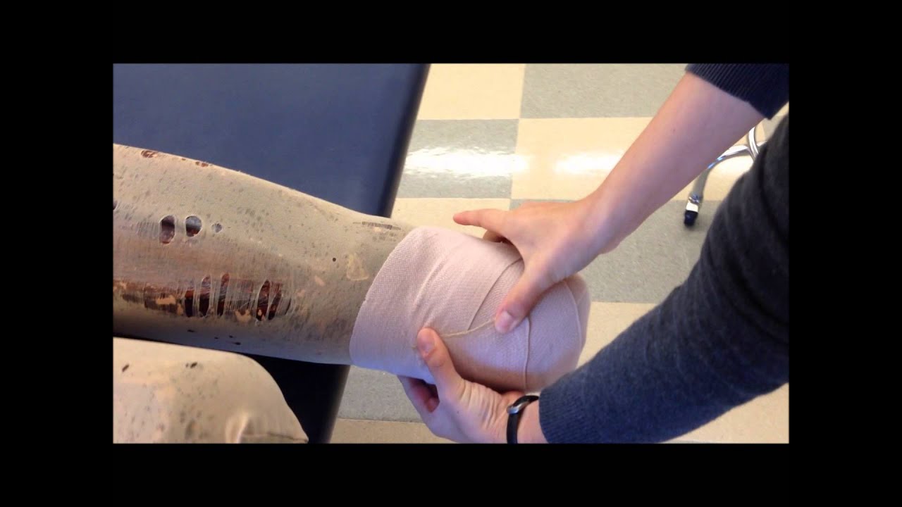 residual limb residual limb