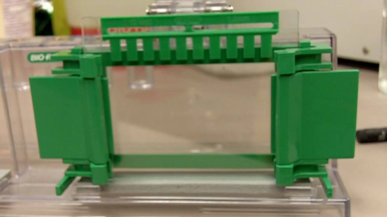 electrophoresis | Canadian BioTechnologist2.0