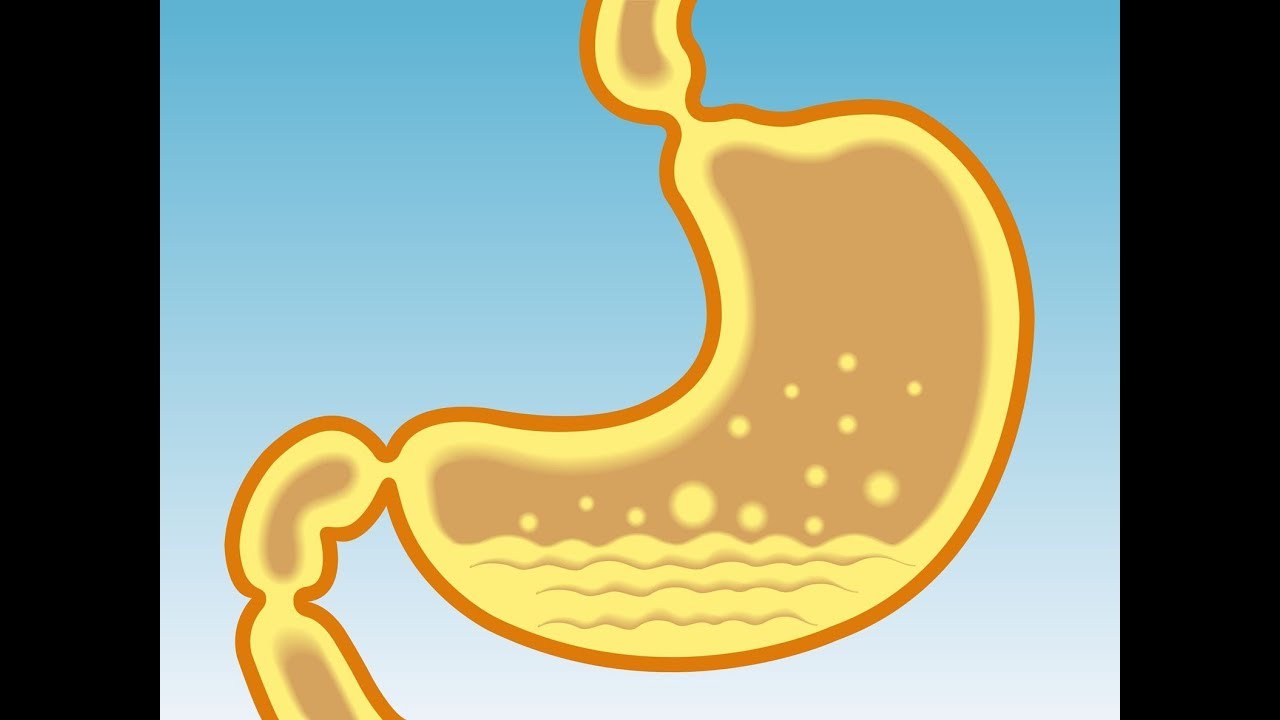 Избавиться от ИЗЖОГИ, ГАСТРИТА и ЯЗВЫ навсегда можно ВСЕГО ЗА 1 НЕДЕЛЮ ...