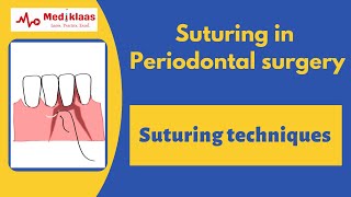 Suturing in Periodontal Surgery l Suturing techniques l Wound suturing l Mediklaas by Mediklaas 17,350 views 3 years ago 10 minutes, 27 seconds