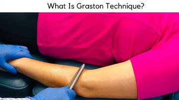 What Is Graston Technique?