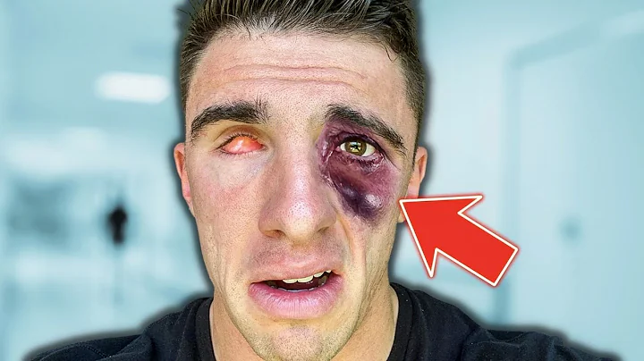 i'm losing my real eye..