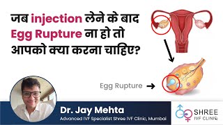 जब injection लेने के बाद egg rupture ना हो तो आपको क्या करना चाहिए? | Egg rupture | Dr Jay Mehta