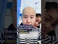 Chinese cancer survivor inspires through dance