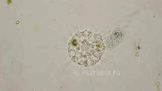 Heliozoan eats a ciliate/ Солнечник ловит и поглощает инфузорию