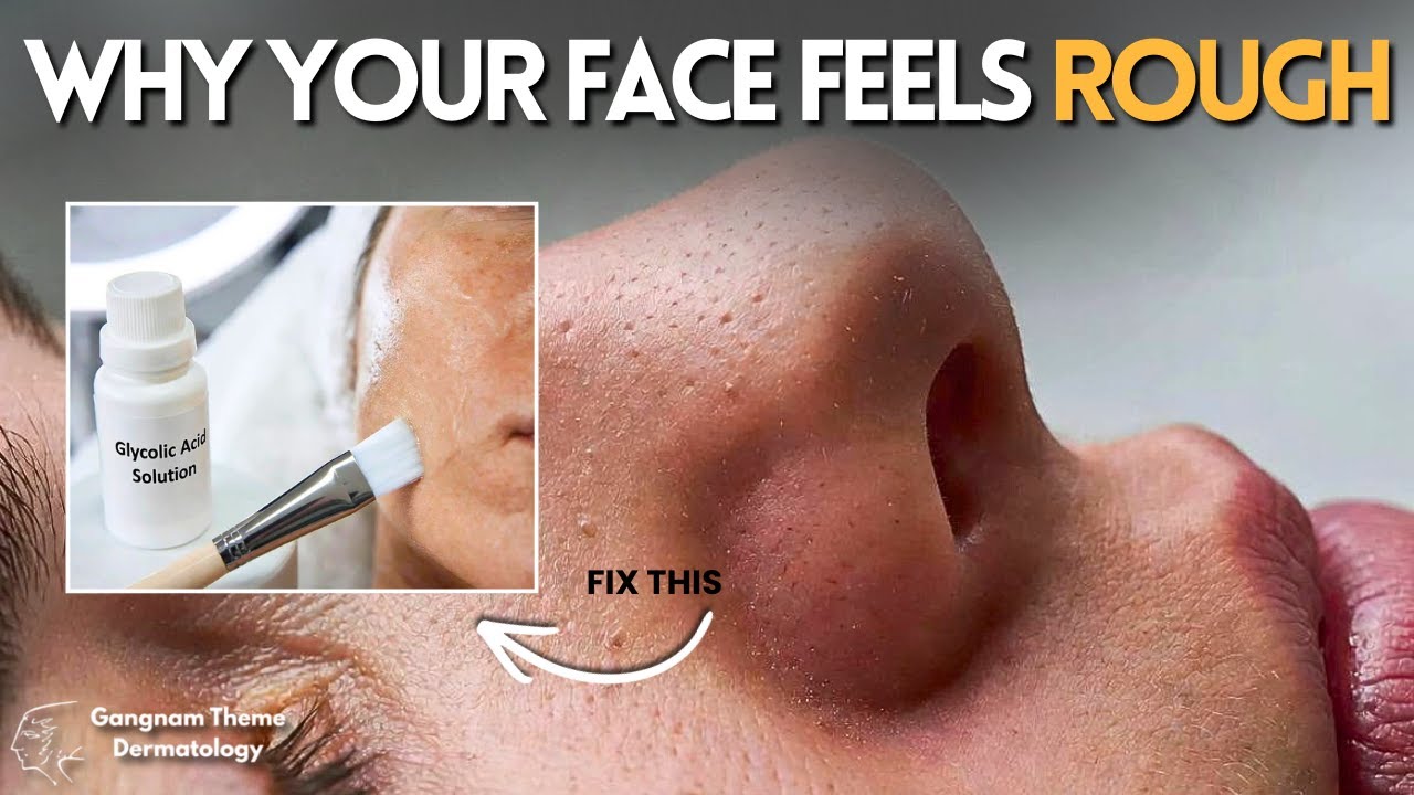 Dull, Rough Skin? Facial Scaling Treatment for Clear & Glowing Skin ...