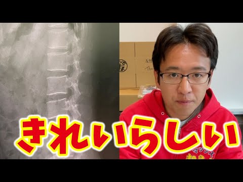 【ご報告】ぎっくり腰でした→病院の先生「39歳にしては背骨きれい」