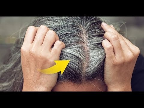 Video: Վաղ գորշ մազեր. Ինչպես պայքարել