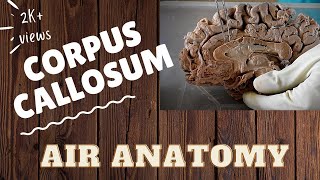 Corpus callosum | Air Anatomy