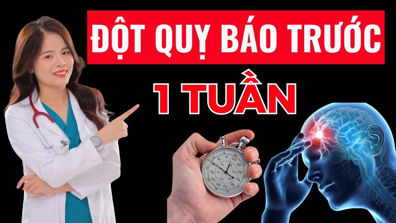 Dấu hiệu nhận biết đột quỵ não xảy ra trước 1 tuần | Dr Thùy Dung