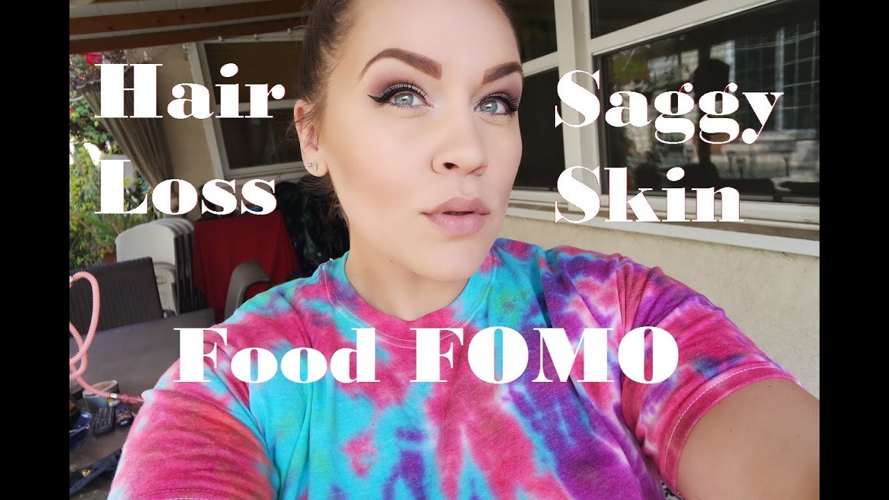 4 Months Post Op VSG Hair loss, Saggy Skin, Food FOMO YouTube