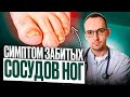 5 ПРИЗНАКОВ ЗАБИТЫХ СОСУДОВ НОГ. Как проверить дома без врача?