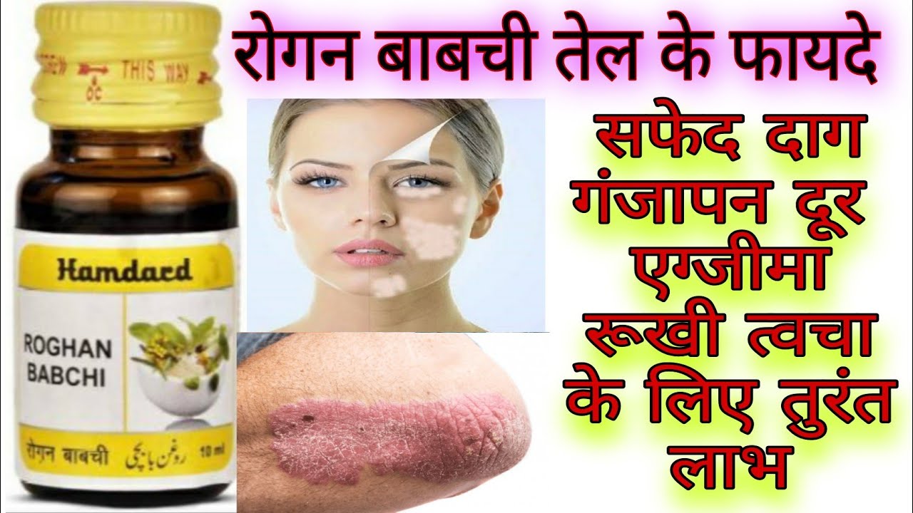Roghan Babchi Oil।। Hamdard Roghan Babchi Oil।। Roghan Babchi Ke Fayde