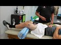 Cupping Variations of the Quadriceps