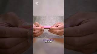 Download Lagu Waarom worden mannen kaal? MP3 Download Lagu Waarom worden mannen kaal? MP3