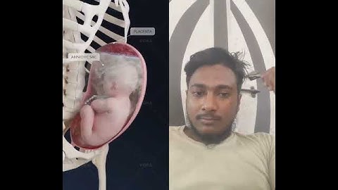 What is mixed breech presentation and why is cesarean recommended? Obstetrics in 3D with VOKA