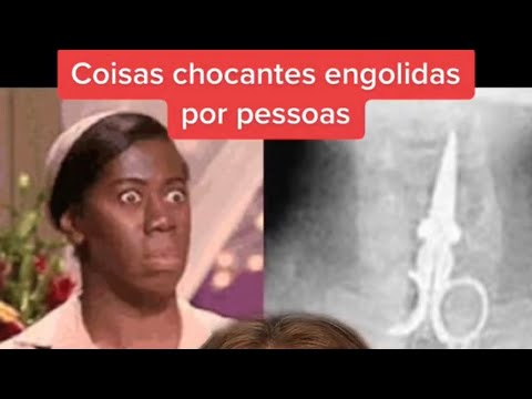 COISAS CHOCANTES ENGOLIDAS POR PESSOAS😦 #shorts #curiosidades